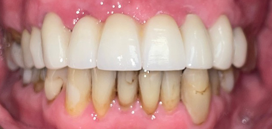 Healthy white smile after dental treatment