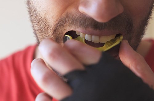 Nose-to-shoulder closeup of man inserting yellow mouthguard over upper arch