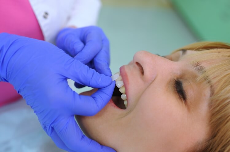 Dentist comparing dental patient's smile to metal free dental restoration color options