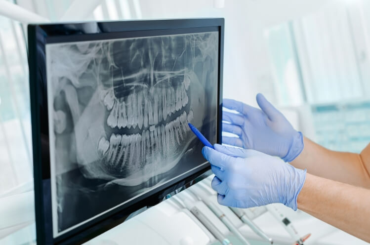 Dentist looking at digital x-rays