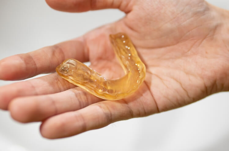 Hand holding a nightguard for bruxism