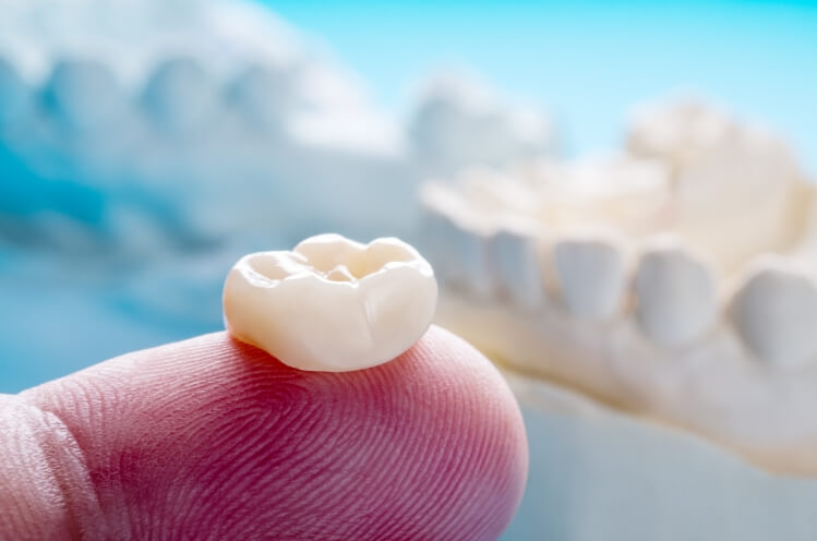 CEREC same day dental crown on fingertip