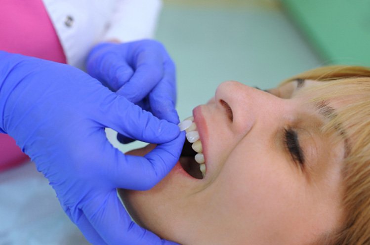woman getting veneers in East Gwillimbury