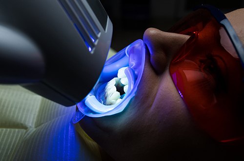 in office teeth whitening in East Gwillimbury